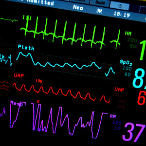 Electronic-intensive-care-unit-eICU-is-coming-to-Asia